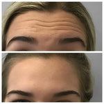 Charger l'image dans la galerie, Botox Naturel Sérum Anti-Âge Rapide et Efficace SG