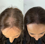 Charger l'image dans la galerie, Sérum roll-on pour la croissance des cheveux
